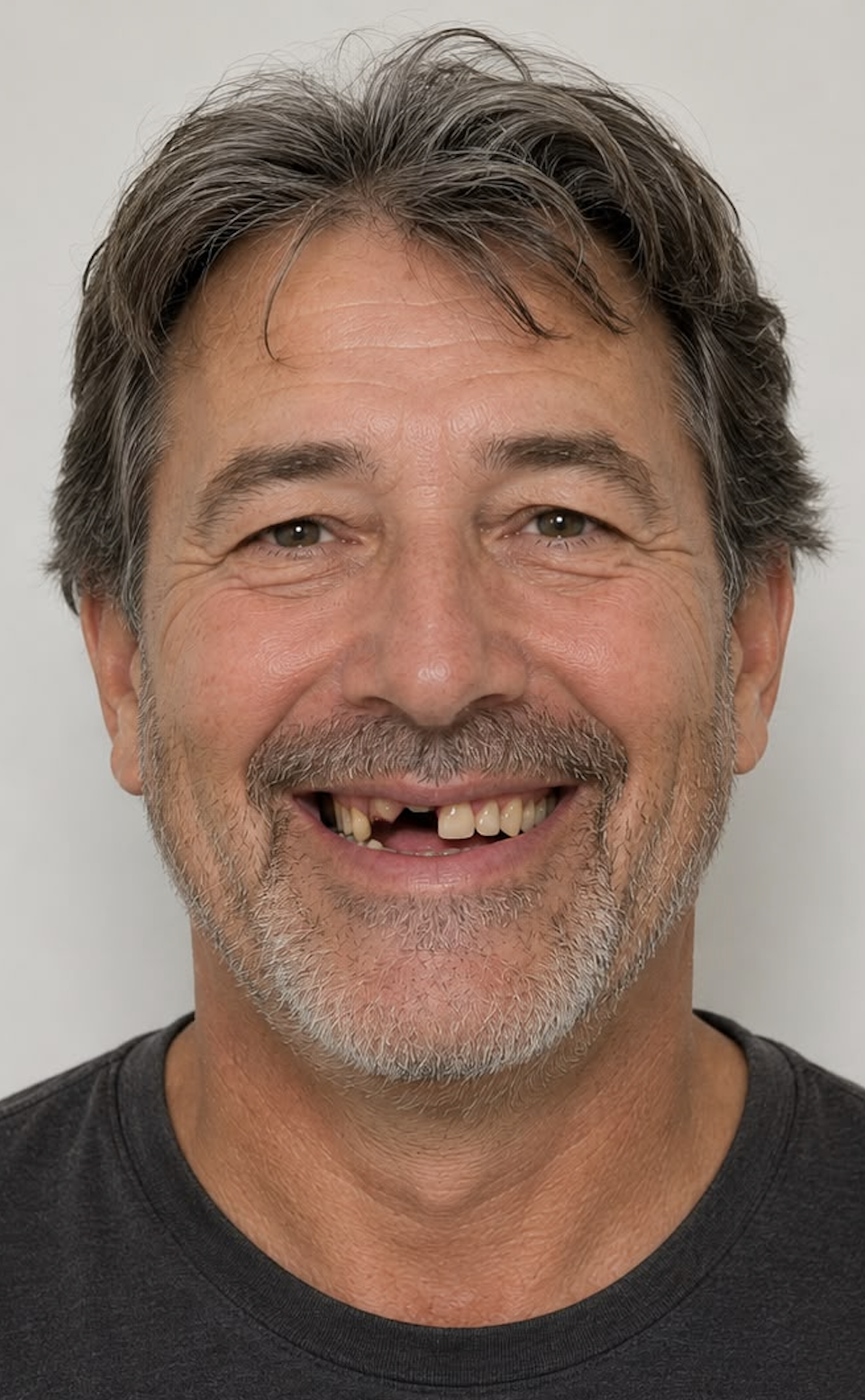 Patient smile before restorative dental treatment